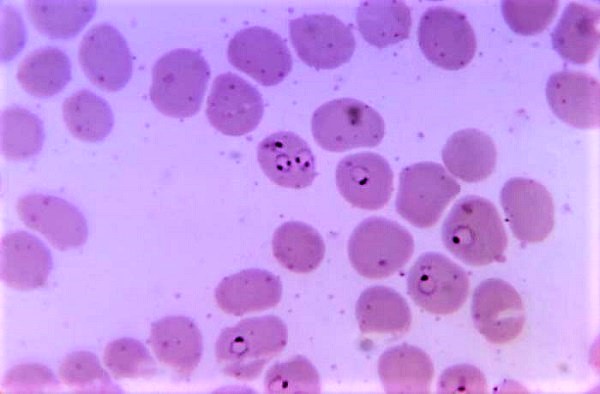 Plasmodium falciparum (cortesía CDC)